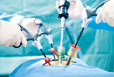 Laparoscopic Surgery