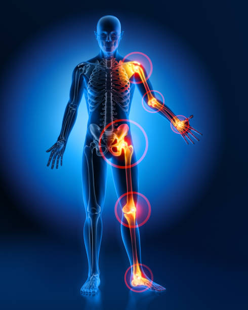 Joint, Knee & Hip Replacement